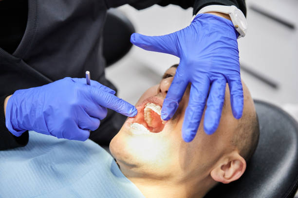 Best Emergency Dentist for Lost Fillings or Crowns in Atascocita, TX